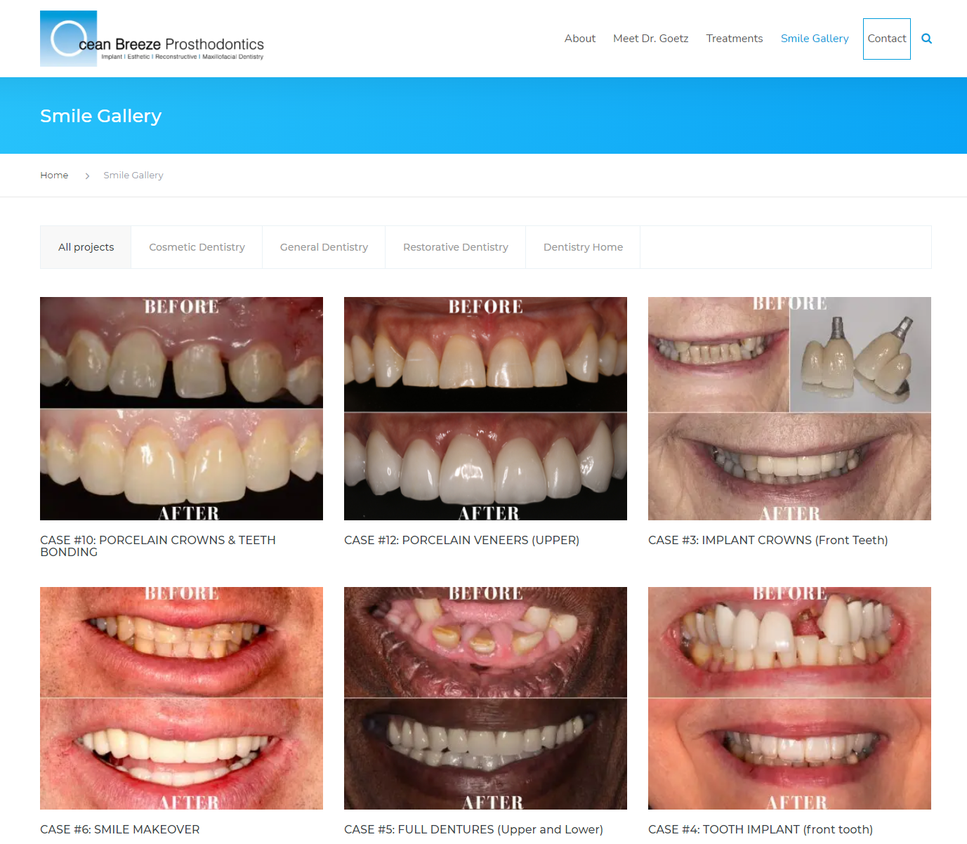 Before After Dental Patients